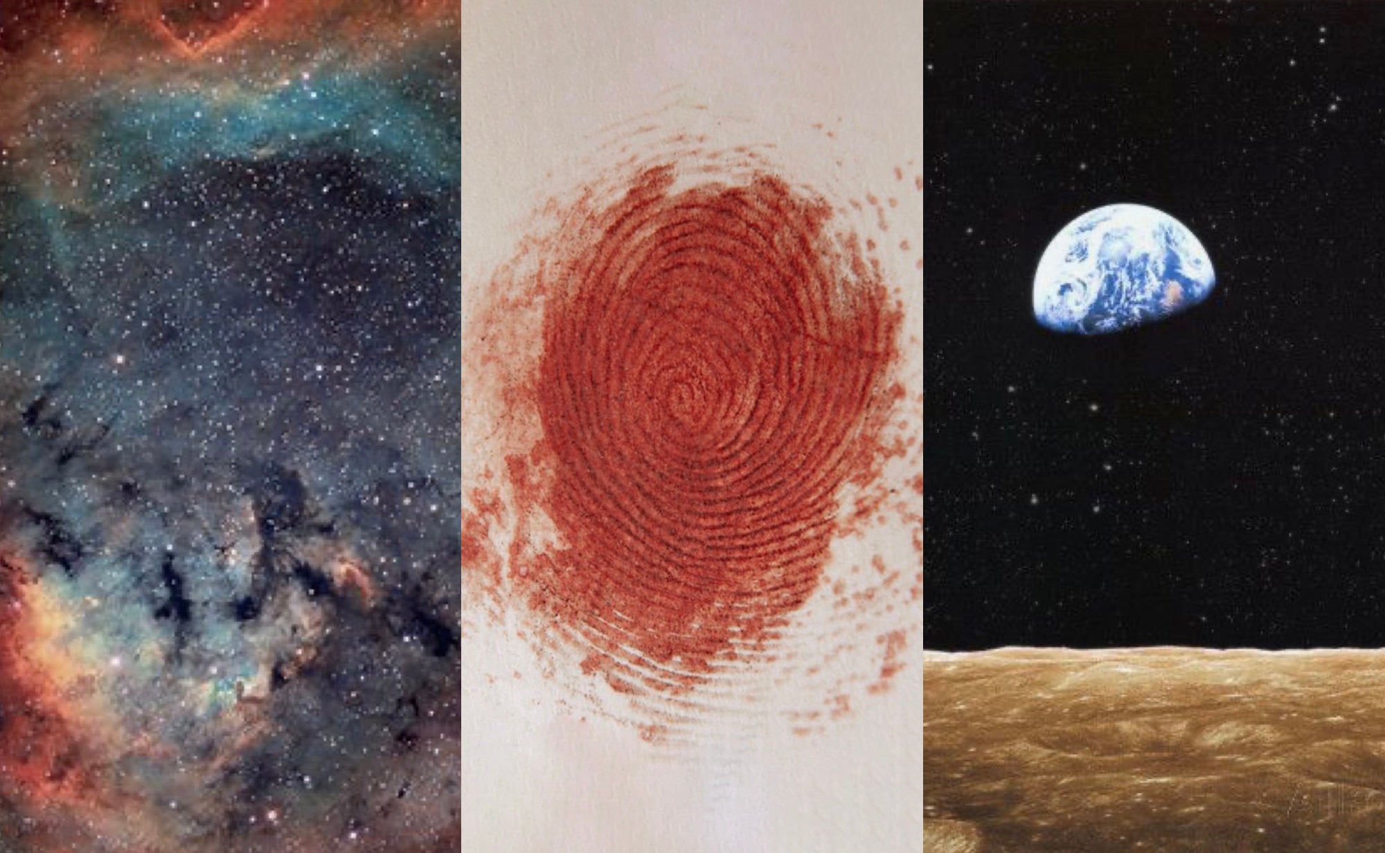 Anomaly